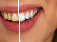 Студия отбеливания зубов Dental SPA studio  на сайте Vyhino-julebino.ru