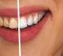 Студия отбеливания зубов Dental SPA studio  на сайте Vyhino-julebino.ru